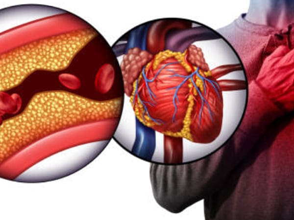 Cardiólogo cerca de Cuauhtémoc