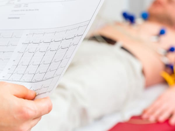 Cardiólogos especialistas en arritmias