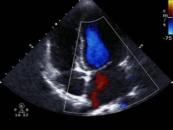 Costo de ecocardiograma transtorácico