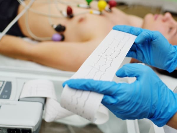 Estudios de cardiología