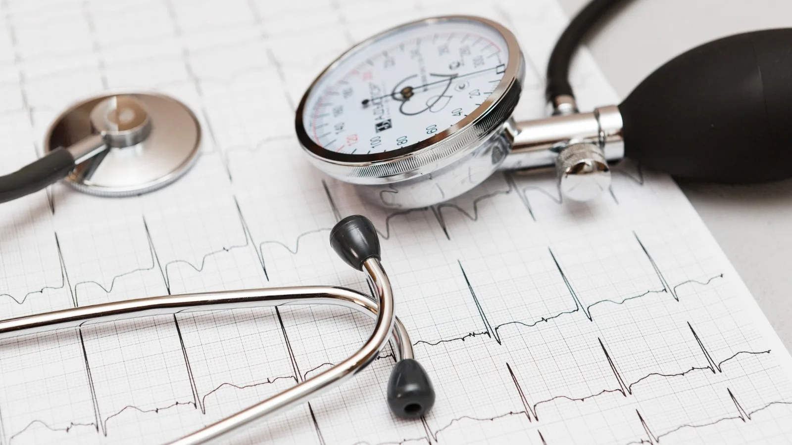 Atención especializada y prevención integral del infarto en la CDMX